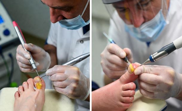 دکتر متخصص ناخن در اصفهان